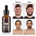 4pcs/set Beard Growth Kit Hair Enhancerbeard Essential Oil Moisturizing Hair Wax Roller Comb For Men Barbe Beard Styling Care. 