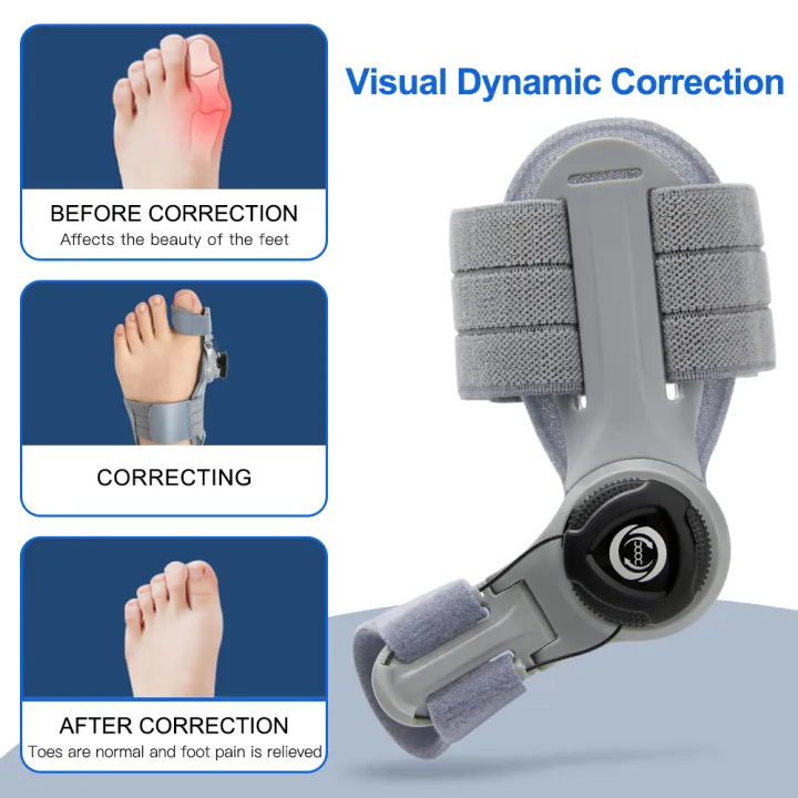 Bunion%20Corrector%20Unisex%20Foot%20Hallux%20Valgus%20Braces%20Rotatable%20Toe%20Separator%20Straightener%20Adjustable%20Pedicure%20Finger%20Toe%20Corrector%20-%20Image%203