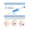 Painless Wart Remover Pen Auto Skin Tag Removal Kit Mole Acne Wart Removal Pen Set Cleansing Swabs Body Beauty Care Tool. 