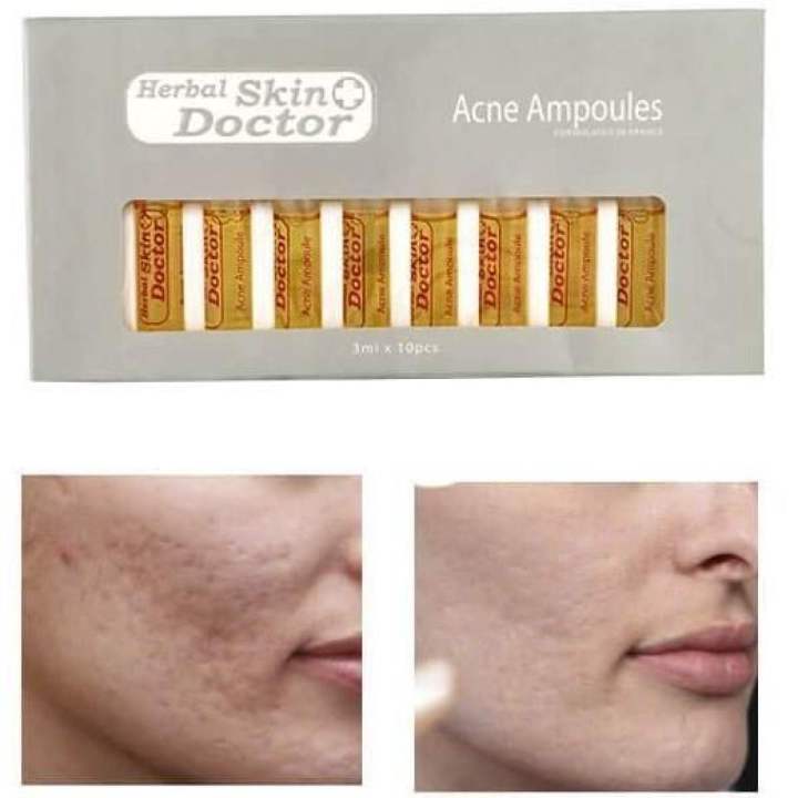 Skin%20Doctor%20Ampoules%20pimple%20&%20Acne%20care%20whitening%20herbal%20serum%20-%201%20ampoule%20-%20Image%203