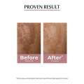 New Eucerin Spotless Brightening 30 ml Serum Pigmented Skin Dark Spots Derma Face Skincare. 