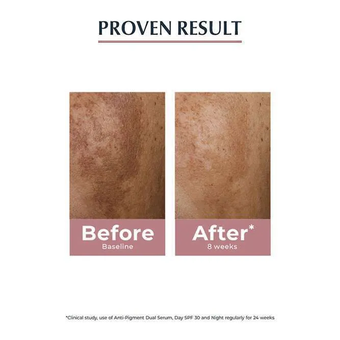 New%20Eucerin%20Spotless%20Brightening%2030%20ml%20Serum%20Pigmented%20Skin%20Dark%20Spots%20Derma%20Face%20Skincare%20-%20Image%202