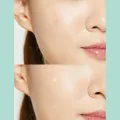 COSRX Acne Pimple Master Patch (24 patches/1ea). 