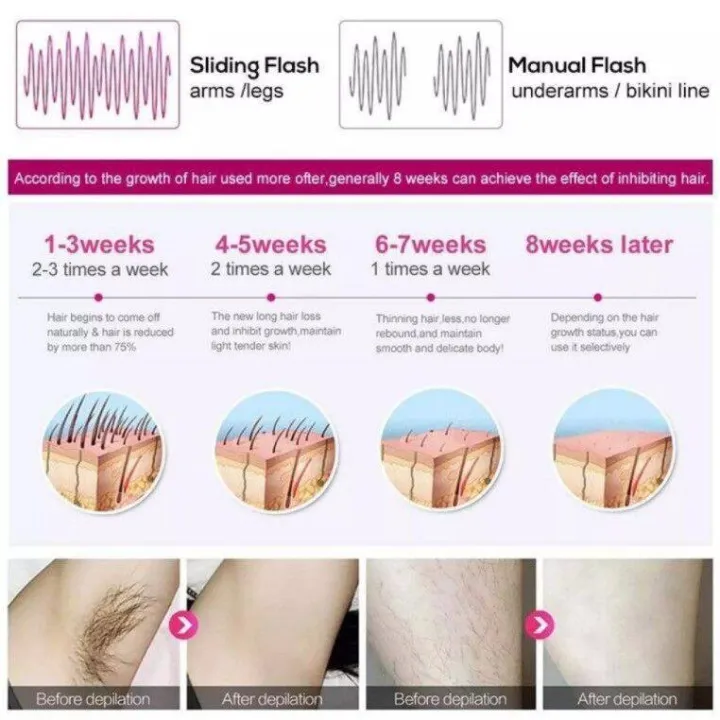 IPL%20Laser%20Hair%20Removal%20Machine%20100W%20Pulse%20Rechargeable%20Female%20Shaver%20%E6%B0%B8%E4%B9%85%E6%80%A7%E6%BF%80%E5%85%89%E9%99%A4%E6%AF%9B%E5%99%A8/Body%20Facial%20Leg%20Dkin%20Hair%20Removal%20Machine%20-%20Image%206