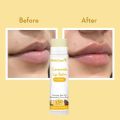 WishCare Ceramide Lip Balm with SPF50 PA+++ - Kojic Acid & Niacinamide - For Lip Lightening & Protection 5gm(FROM INDIA)JEZ. 