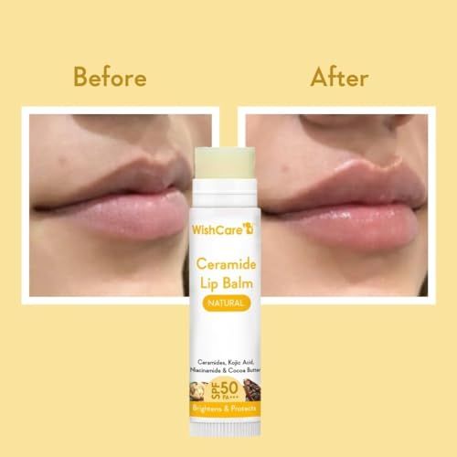 WishCare%20Ceramide%20Lip%20Balm%20with%20SPF50%20PA+++%20-%20Kojic%20Acid%20&%20Niacinamide%20-%20For%20Lip%20Lightening%20&%20Protection%205gm(FROM%20INDIA)JEZ%20-%20Image%203