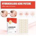 1 【Hot】 Pimple Patch 144 PCS Mighty Pimple Healing Patches Hydrocolloid Acnes Pimple Patch For Zits Blemishes Spot Stickers Facial Care. 