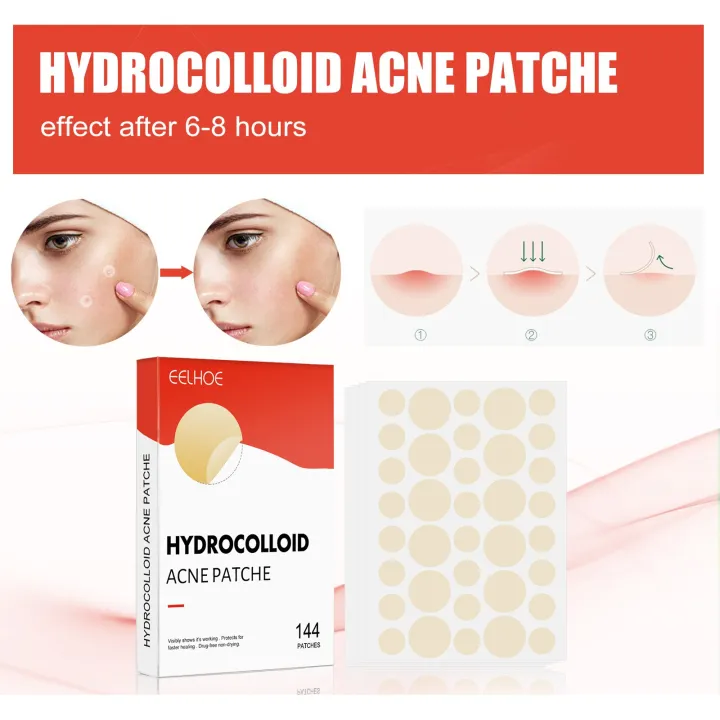 1%20%E3%80%90Hot%E3%80%91%20Pimple%20Patch%20144%20PCS%20Mighty%20Pimple%20Healing%20Patches%20Hydrocolloid%20Acnes%20Pimple%20Patch%20For%20Zits%20Blemishes%20Spot%20Stickers%20Facial%20Care%20-%20Image%204