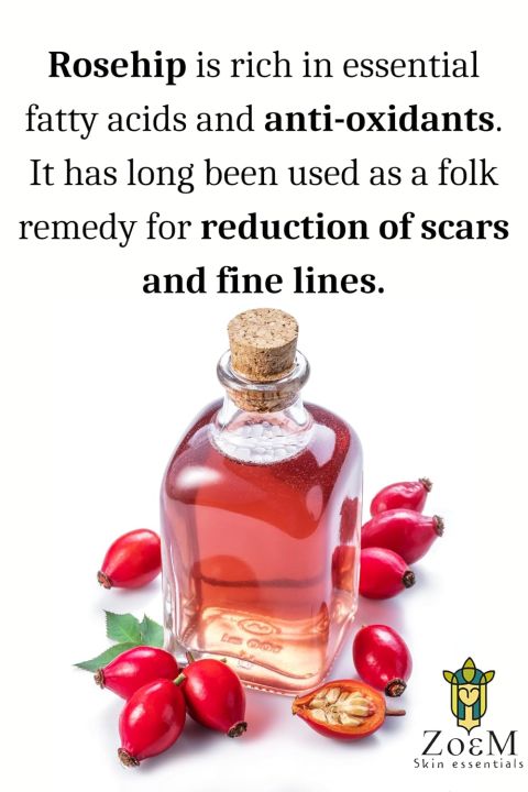 ZoeM%20Skin%20Essentials%20Dark%20Spot%20Correcting%20Glow%20Serum%20For%20Women%20%7C%20Natural%20Retinol%20%7C%20Hyperpigmentation%20Serum%20%7C%20Spot%20Corrector%20For%20Acne%20%7C%2030ml%20(FROM%20INDIA)SAB%20-%20Image%204