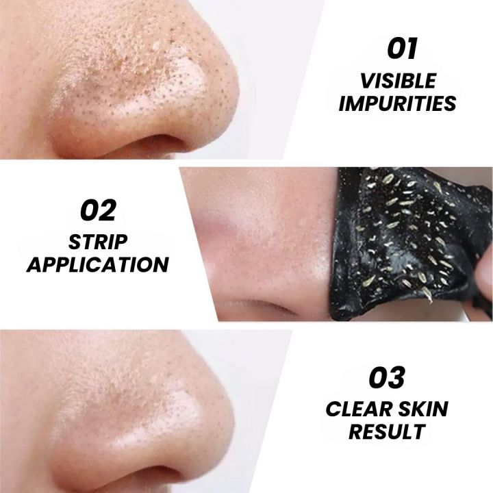 Original%20Deep%20Cleansing%20Blackhead%20Removal%20Strips%20for%20Nose%20%E2%80%93%20Pack%20of%2010%20-%20Easy%20Use%20-%20Image%203