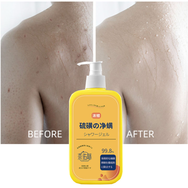 400ml%20Shower%20Gel%20Sulfur%20Liquid%20Mite%20Removal%20Soap%20Cleaner%20Bar%20Soap%20Acne%20Treatment%20Reduce%20Oil%20Keeps%20Pores%20Cleaner%20Hand%20Sulfur%20Soap%20-%20Image%203