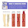 Varicose Vein Treatments Cream Effective Relieve Legs Dilated Vasculitis Phlebitis Natural Formula Ointment For Varicose Veins. 