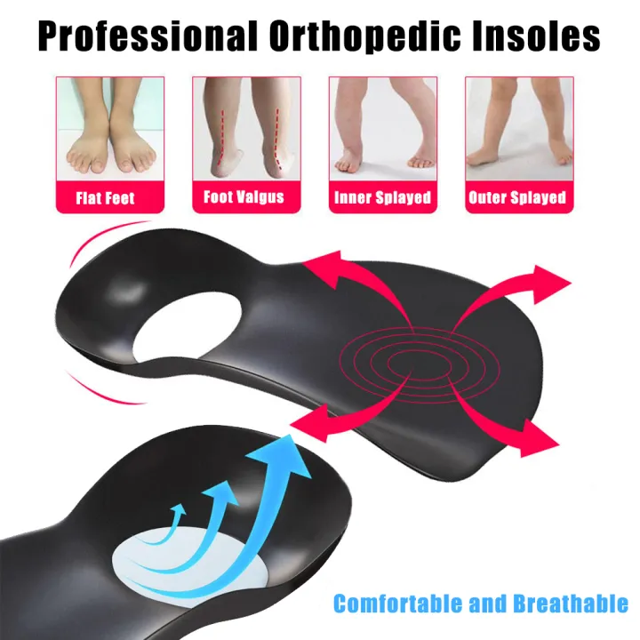 Orthotic%20Insoles%20for%20XO-Legs%20Correction%20Orthopedic%20Insoles%20Flat%20Foot%20Arch%20Support%20Pad%20Plantar%20Fasciitis%20Pain%20Relief%20Shoe%20Inserts%20-%20Image%204
