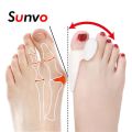 【HOT】 1Pair Silicone Toe Separator Bunion Splint Big Toe Bone Hallux Valgus Overlapping Corrector Shoe Insert Foot Care Orthosis Tools. 