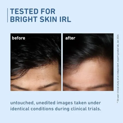 Plum%2010%25%20Niacinamide%20Serum%20with%20Rice%20Water%20%7C%20Provides%20Clear,%20Glowing%20&%20Brightening%20Skin%20%7C%20for%20Acne%20Prone,%20Combination,%20Oily%20&%20Sensitive%20Skin%20%7C%20Oil%20Control%20&%20Anti%20Acne%20Face%20Serum%20for%20Women%20&%20Men%20%7C%2015ml%20%20(FROM%20INDIA)%20-%20Image%203