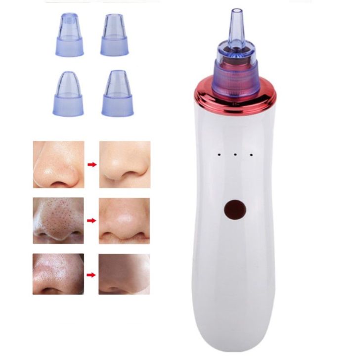 Electric%20Blackhead%20Remover%20Vacuum%20Suction%20Kit%20USB%20Rechargeable%20Portable%20Face%20Deep%20Nose%20Acne%20Pore%20Cleaner%20Pimple%20Eraser%20Multifunctional%20Skin%20Care%20Beauty%20Device%20TBS%20-%20Image%203