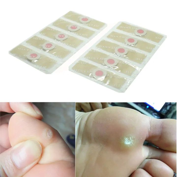 【TrendGlobe】36pcs Medical plaster Foot Corn Removal Remover Warts Thorn ...