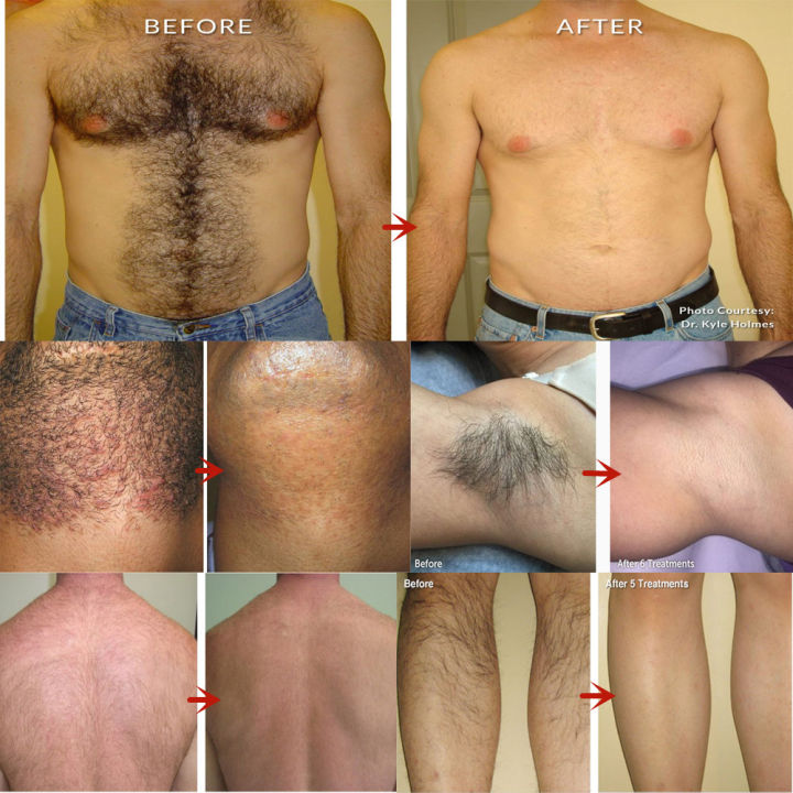 50g%20Permanent%20Hair%20Removal%20Cream%20Painless%20Armpit%20Leg%20Arm%20Private%20Part%20Hair%20Remover%20Hair%20Growth%20Inhibitor%20For%20Man%20Woman%20Body%20Care%20-%20Image%202