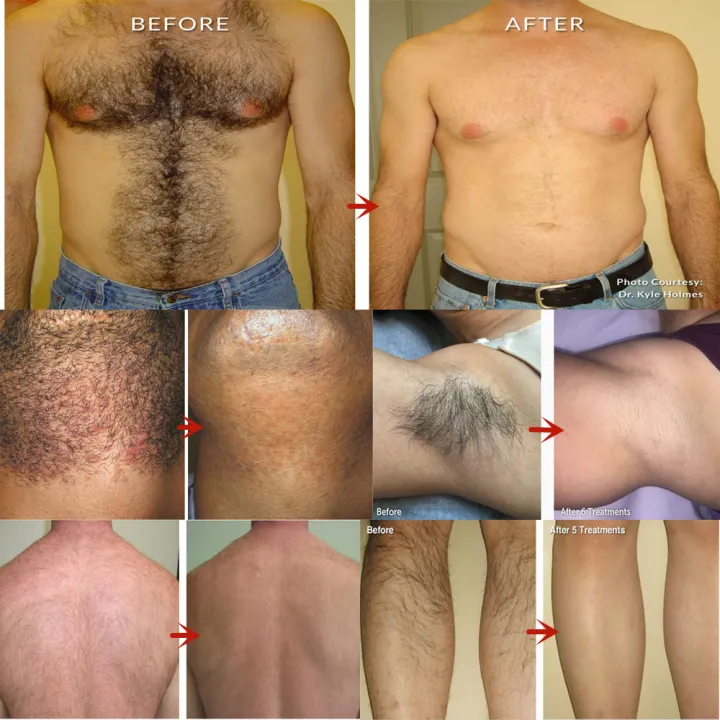 New%20specials%2050g%20Permanent%20Hair%20Removal%20Cream%20Painless%20Armpit%20Leg%20Arm%20Private%20Part%20Hair%20Remover%20Hair%20Growth%20Inhibitor%20For%20Man%20Woman%20Body%20Care%20-%20Image%202