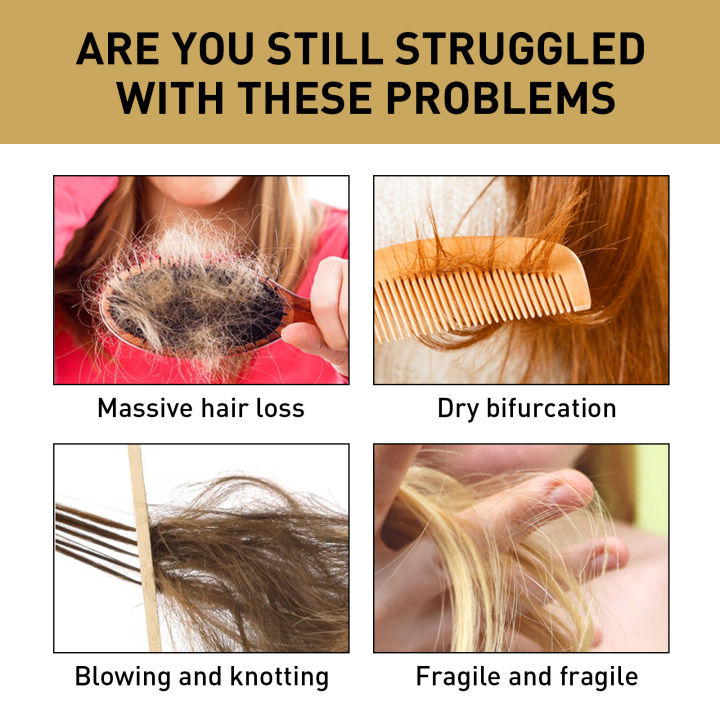 Ginger%20Regrowth%20Shampoo%20Anti%20Hair%20Loss%20Oil%20Control%20Dandruff%20Removal%20Moisturiz%20Nourish%20Scalp%20Repair%20Damaged%20Hair%20Growth%20Shampoo%20-%20Image%204