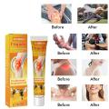 20g Joint Bone Therapy Gel Bee Venoms Propolis Bee Professional Treatments Gel Bee Venoms Gel For Legs Hands Arms Feet. 