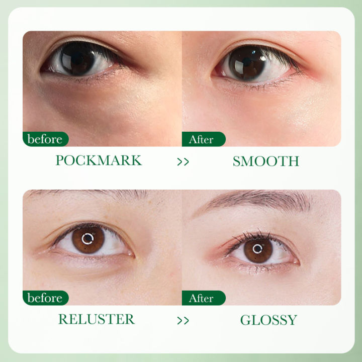 BIOAQUA%20Centella%20Asiatica%20Nourish%20Repair%20Eye%20Cream%20Moisturizing%20Eye%20Care%20Cream%2020g(FROM%20MALAYSIA)%20-%20Image%206