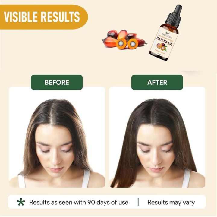 Homeda%20Batana%20Oil%20for%20Hair%20Growth%20Organic%20(15%20ml),%20Pure%20Botana%20oil%20for%20hair%20growth,%20Doctor%20Truth%20Batana%20Oil,%20Dr%20Sebi%20100%25%20Raw%20Btana%20Hair%20Oil%20Cold%20Pressed,%20Batona,%20Batana,%20Bantana,%20Batna%20%20%20(FROM%20INDIA)%20-%20Image%203
