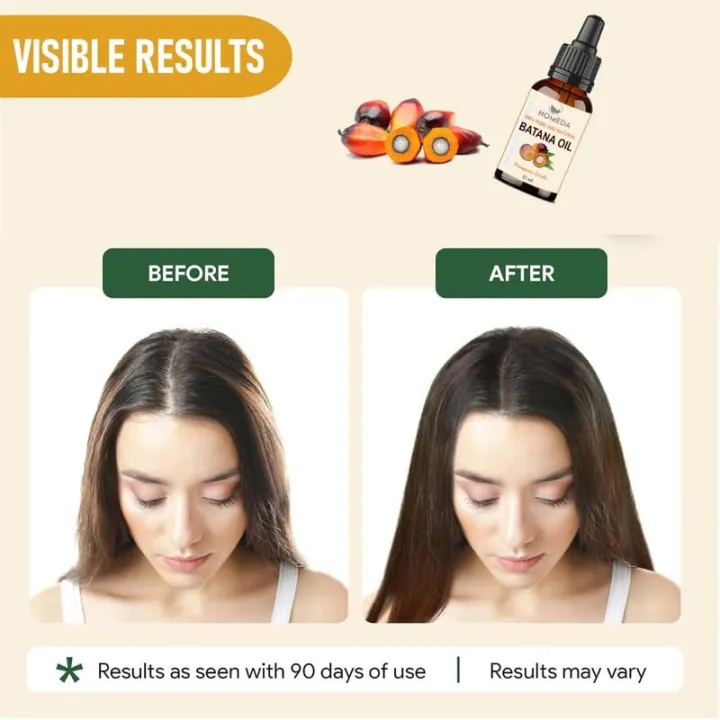 Homeda%20Batana%20Oil%20for%20Hair%20Growth%20Organic%20(15%20ml),%20Pure%20Botana%20oil%20for%20hair%20growth,%20Doctor%20Truth%20Batana%20Oil,%20Dr%20Sebi%20100%25%20Raw%20Btana%20Hair%20Oil%20Cold%20Pressed,%20Batona,%20Batana,%20Bantana,%20Batna%20%20%20(FROM%20INDIA)%20-%20Image%203