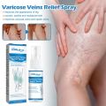 Spray for Varicose Veins Effective Varicose Vein Relief Cream To Relieve Leg Vasculitis Phlebitis Spider Pain Swelling Treatment. 