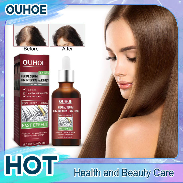 Hair Restoration Serum Fast Growing Nourish Scalp Prevent Hair Loss Firming Root Repair Dry Damaged Moisturize Hair Regrowth Oil