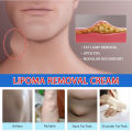 Lipoma Removal Cream Relief Pain Treat Skin Swelling Lipolysis Cellulite Fat Lump Nodule Removal Ointment Anti-tumor Plaster. 