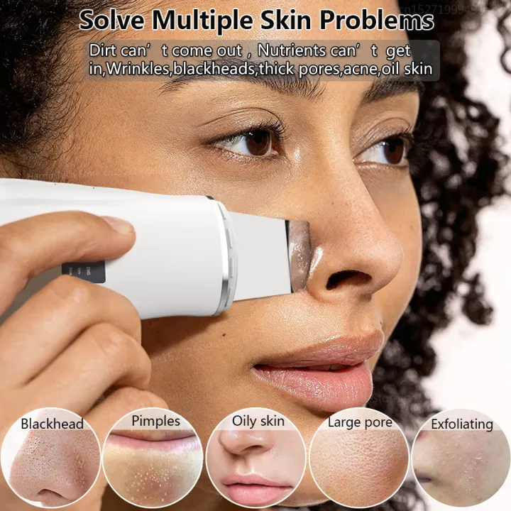 Facial%20With%20Blackhead%20Removal%7Cvanity%20Planet%20Ultrasonic%20Skin%20Scrubber%20-%20Ems%20Facial%20Cleansing,%20Blackhead%20Removal%20-%20Image%203