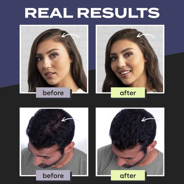 Toppik%20hair%20building%20fiber%20BLACK%2027.5g%20Made%20in%20USA%20,ORGINAL%20Product%20-%20Image%204