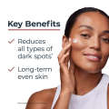 New Eucerin Spotless Brightening 30 ml Serum Pigmented Skin Dark Spots Derma Face Skincare. 