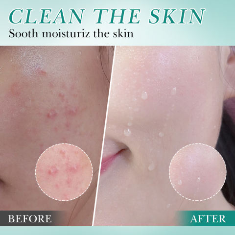 BIOAQUA%20Hyaluronic%20Acid%20Cleanser%20Moisturise%20Soothing%20Gentle%20Moisturising%20Deeply%20Clean%20Pores%20Soothing%20Skin%20100g(FROM%20MALAYSIA)%20-%20Image%202