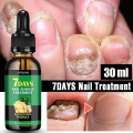 7 Day Nail Fungal Treatment Serum Foot Toe Nail Fungus Removal Essential Oil Infection Onychomycosis Paronychia Repair Gel. 