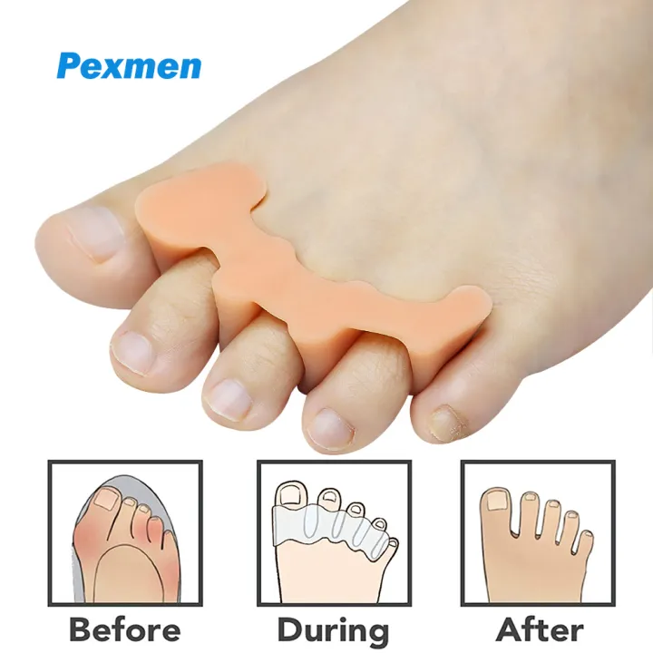 Pexmen 2Pcs Gel Toe Separators Toe Spacers Spreaders Straighteners to ...