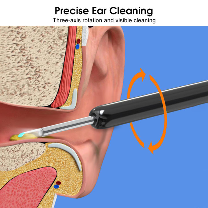 HEGRUS%20Ear%20Pick%20LED%20Flashlight%20Visible%20Ear%20Spoon%20Ear%20Wax%20Removal%20Ear%20Cleaner%20Visual%20Ear%20Scope%20Camera%20Safe%20Ear%20Pick%20Ear%20Cleaning%20Tool%20with%20HD%20Camera%20for%20iPhone,%20iPad%20&%20Android%20Smart%20Phones%20-%20Image%204