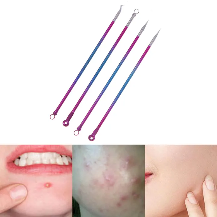 NEW%204pc%20Acne%20Pimple%20Belmish%20Extractor%20Vacuum%20Extrusion%20Acne%20Stick%20Blackhead%20Blemish%20Removers%20Against%20Black%20Dots%20Tools%20For%20Face%20Clean%20-%20Image%205