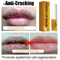 Anedshaop Remove Dark Smoke Lip Balm Lightening Melanin Bleaching Gloss Oil Fashion Lips Pink Lipstick Exfoliating Fade Lip Lines Korean Cosmetics. 
