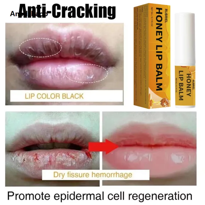 Anedshaop%20Remove%20Dark%20Smoke%20Lip%20Balm%20Lightening%20Melanin%20Bleaching%20Gloss%20Oil%20Fashion%20Lips%20Pink%20Lipstick%20Exfoliating%20Fade%20Lip%20Lines%20Korean%20Cosmetics%20-%20Image%203