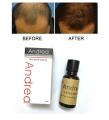 Andrea Hair Growth Oil. 