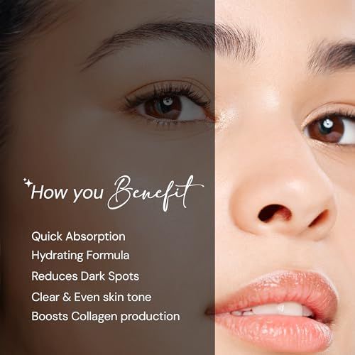 Vitaderm%20Skin%20Lightening%20Cream%2020gm%20Dermatologist%20Prescribed%20with%20Niacinamide10%25%20Hyaluronic%20Acid%20&%20Red%20Algae%20Extract%20Helps%20in%20Skin-Brightening%20&%20Reduce%20Dark%20Spot%20Age%20Spots%20Acne%20Marks%20Hyperpigmentation%20(FROM%20INDIA)SAB%20-%20Image%202