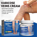 20g Varicose Vein Relief Cream Tongmai Effective Relieves Leg Bulge Pain Plant Extracts Treatment and Repair Cream Skin Care. 