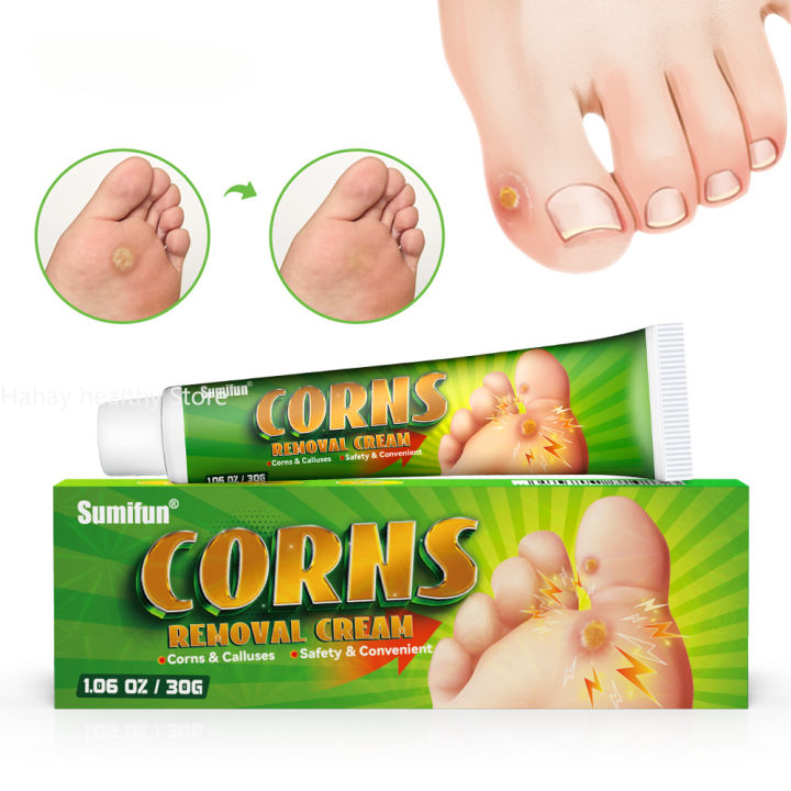 Foot%20Corn%20Remover%20Cream%20Chicken%20Eye%20Skin%20Infection%20Treatment%20Ointment%20Feet%20Dead%20Skin%20Calluses%20Removal%20Tool%20Health%20Care%20%EB%82%B4%EC%84%B1%EB%B0%9C%ED%86%B1%20-%20Image%203