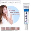 Bioaqua Pure Skin Face Care Acne Treatment Scar Removal Cream Stretch Marks Pimples Blackheads. 