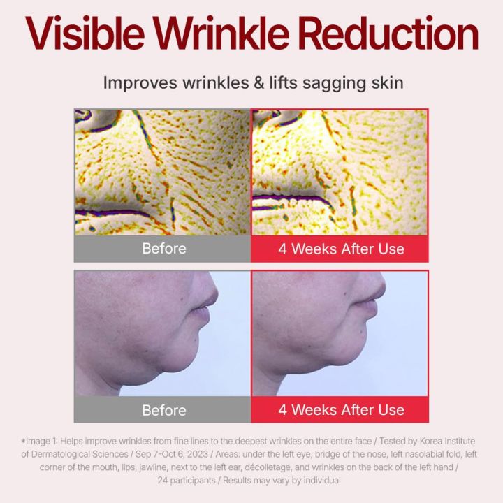 Korean%20Centella%20Asiatica%20Skin%20Care%20CENTELLIAN%2024%20(50ml)%20Fast-Absorbing,%20Wrinkle%20Reduction%20&%20Firming,%20Hydrates%20&%20Nourishes%20Face%20-%20Image%204