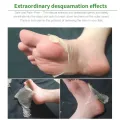 1Pair Aloe Vera Foot Mask Peeling for Legs Feet Mask Scrub Exfoliating Socks for Pedicure Anti Crack Heel Remove Skin Foot Patch. 