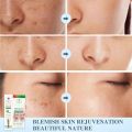 Face Acne Cleaning Cream Skin Care Remove Repair Comedone Pimple  Aichun Beauty Acne Face Acne Cream Moisturizing Fleck Removing Concentration Cleansing Soothing Face Skin. 