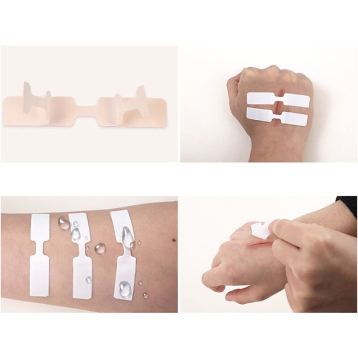 10PCs/Box%20Waterproof%20Band%20Aid%20Butterfly%20Adhesive%20Wound%20Closure%20Band%20Aid%20Emergency%20Kit%20Adhesive%20Bandages%20-%20Image%203